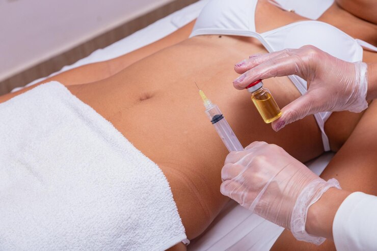 Trattamento di mesoterapia sul corpo di donna segnato