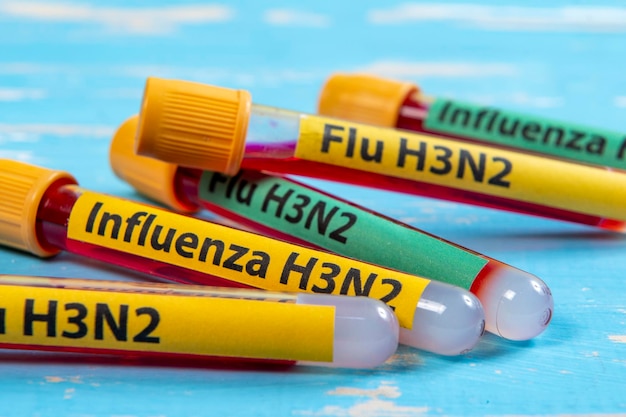 Tubo sottovuoto per la raccolta del sangue scritto FLU H3N2 in riferimento al tipo di influenza