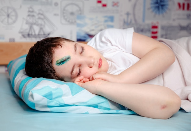 Un bambino con una ferita alla testa dorme su un letto nella sua stanza. Il chirurgo gli ha cucito la pelle sulla fronte