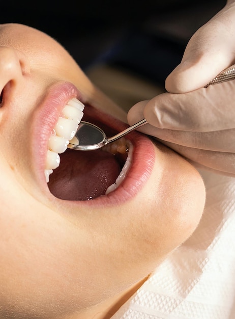 Un dentista che indossa un guanto in mano sta esaminando i denti