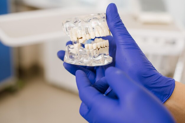 Un dentista mostra al paziente un modello di denti in ceramica e le spiega il lavoro