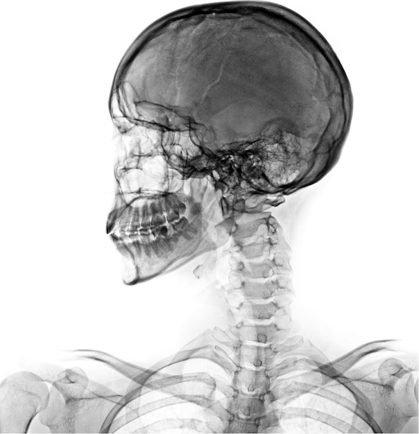 Un'immagine in bianco e nero di una testa umana con la testa di una persona con la testa di un teschio.
