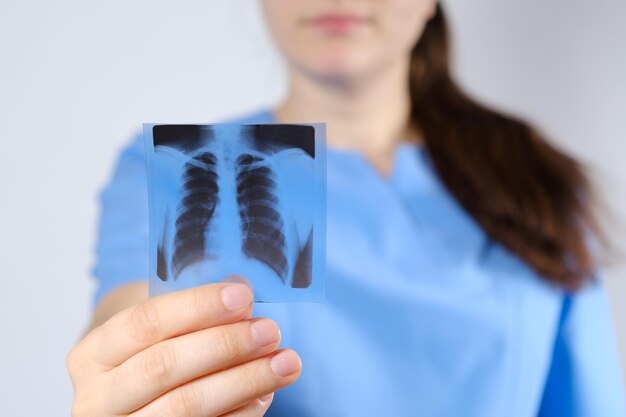 Un medico in uniforme blu mostra l'immagine di un fluorogramma di fluorografia