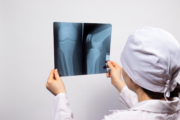 Un medico tiene una radiografia della gamba di una persona