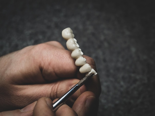 Un odontotecnico fa un denti protesici. laboratorio. avvicinamento.