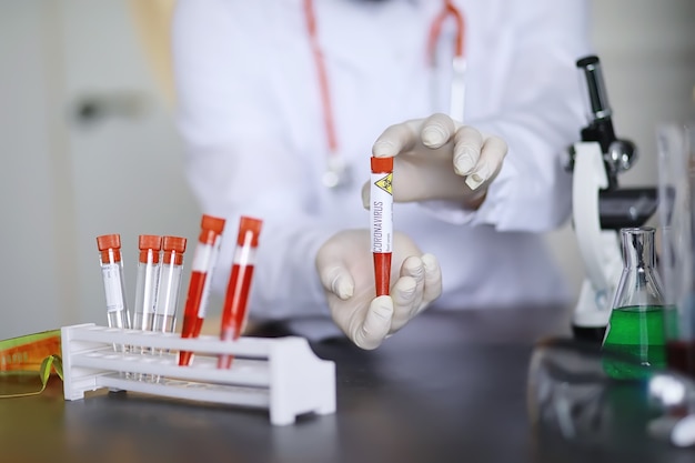 Un ricercatore scienziato in laboratorio sta testando farmaci per il trattamento della polmonite virale. Esame del sangue del coronavirus di pazienti infetti. Pandemia mondiale.