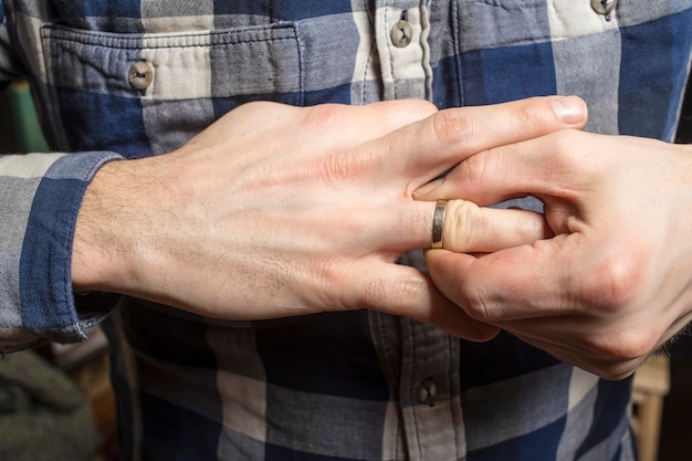 Un uomo che lotta per rimuovere l'anello nuziale dal dito