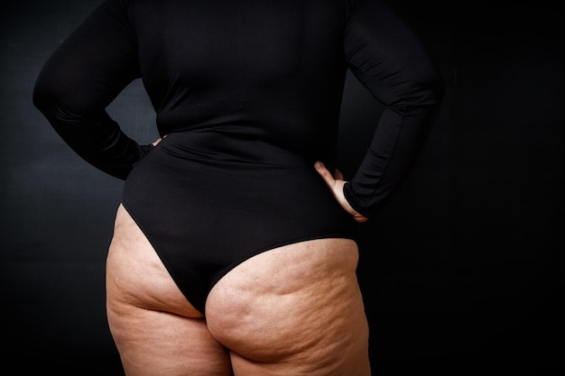 Una donna grassa con la cellulite sulle natiche sta con la schiena su uno sfondo nero Foto di alta qualità