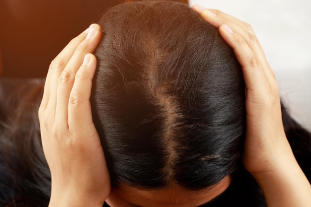 Una donna ha un problema con la caduta dei capelli.