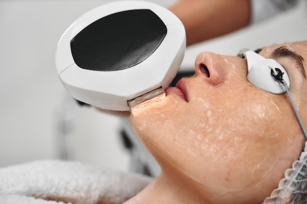 Una donna riceve la terapia ipl in un salone di bellezza foto di alta qualità
