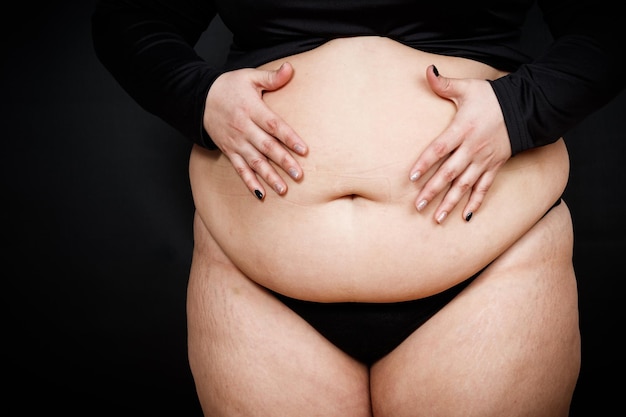 Una donna tiene le mani su una pancia grassa su sfondo nero persona obesa Foto di alta qualità