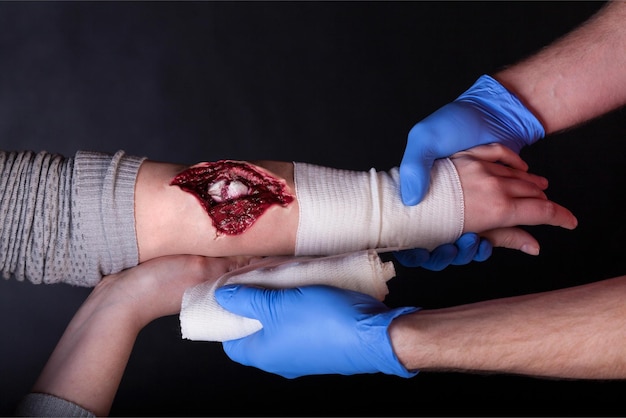 Una persona con una benda sul braccio sta per tagliarsi una mano.