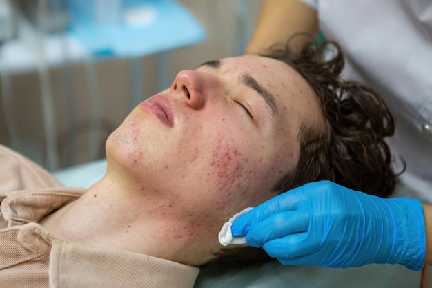 Una procedura per la pulizia del viso meccanica o manuale da parte di un'estetista Peeling professionale della pelle