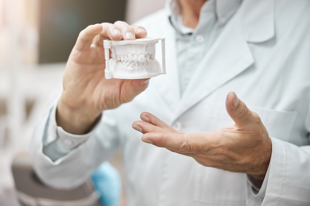 uno stampo in gesso e argilla di mascelle umane tenuto da un medico che indossa un camice da laboratorio