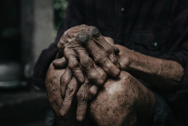 Uomo anziano che si tiene per mano sulle ginocchia a causa dell'assistenza sanitaria della malattia o del concetto di anziani