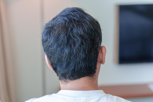 Uomo asiatico con capelli grigi e bianchi che crescono Concetto di problema dei capelli