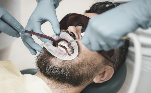 Uomo barbuto che ha i denti esaminati dai dentisti Primo piano di uomini pazienti con barba a bocca aperta seduti...