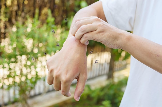 Uomo che prude e si gratta il braccio a causa di un'eruzione cutanea allergica causata dal morso delle zanzare