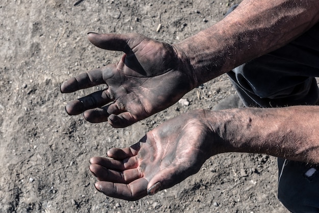 Uomo dei carboni ardenti con le mani sporche. Mani del lavoratore