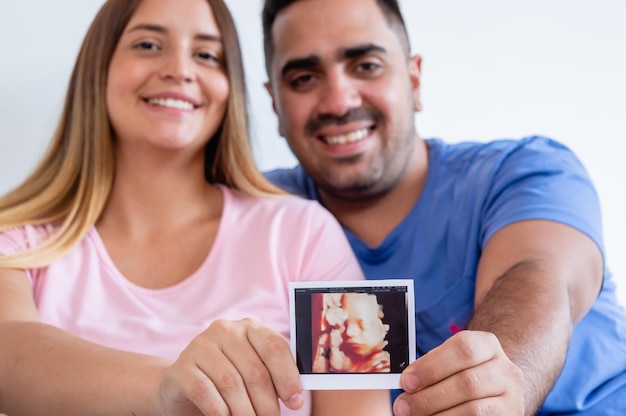uomo e donna incinta sfocati sullo sfondo che mostrano una foto ecografica stampata