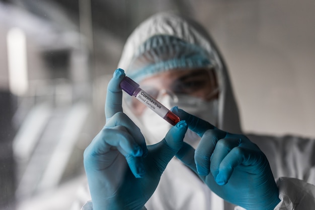 Uomo tecnico da laboratorio indossare in indumenti protettivi tenere sulla provetta di sangue per test del virus corona. Test COVID 19