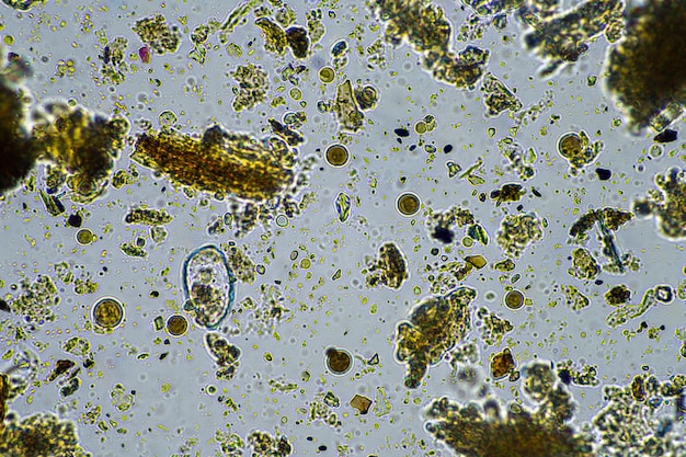 Verme microscopico nel terreno in australia