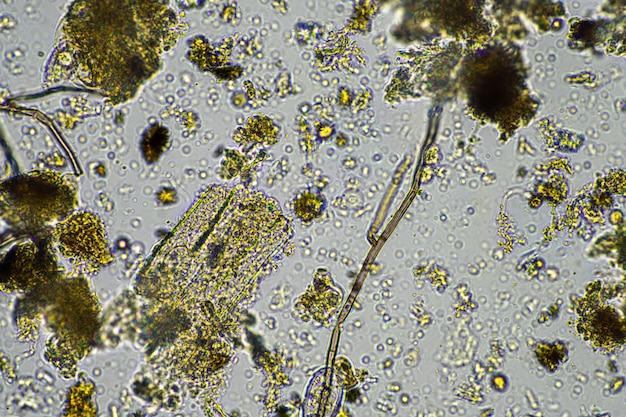 Verme microscopico nel terreno in australia