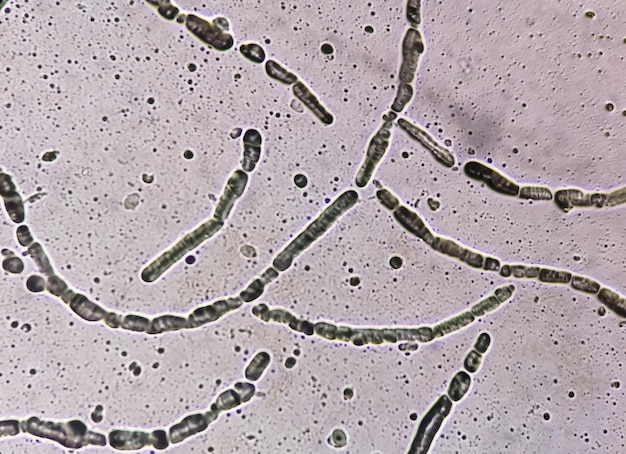 Vista al microscopio del raschiamento delle unghie per il test dei funghi che mostra le ife dei dermatofiti.