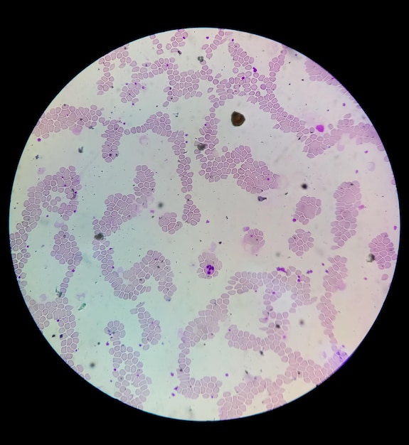 Vista al microscopio del vetrino ematologico