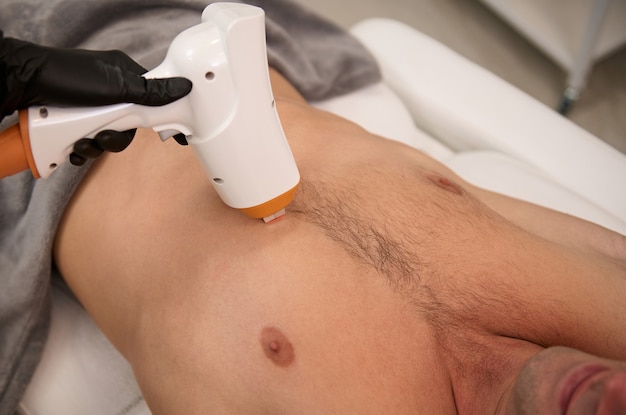 Vista dall'alto del busto di un uomo atleta durante una procedura di depilazione in uno studio di epilazione laser. Depilazione laser per uomini utilizzando una moderna macchina per la depilazione ad ultrasuoni. Ceretta maschile