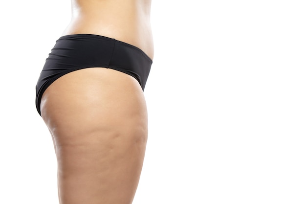 Vista laterale. Donna in sovrappeso con gambe e glutei di cellulite grassa, corpo femminile di obesità in biancheria intima nera isolato su priorità bassa bianca. Pelle a buccia d'arancia, liposuzione, cure sanitarie e di bellezza.