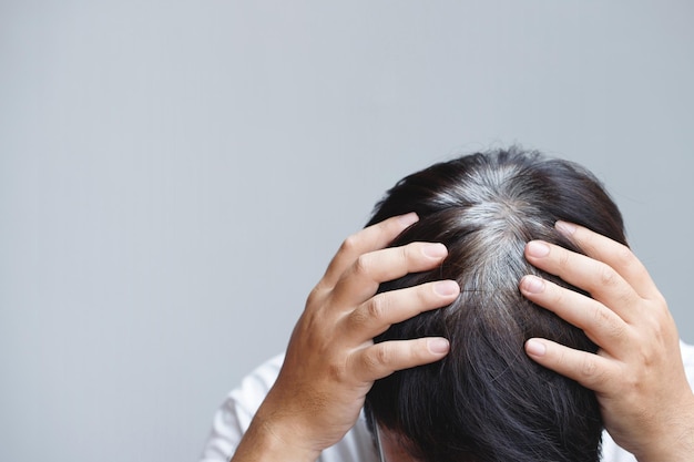 Vista posteriore dei capelli grigi prematuri dei giovani che mostrano le radici dei capelli canuti neri sul cambio di testa all'uomo anziano anziano all'aperto