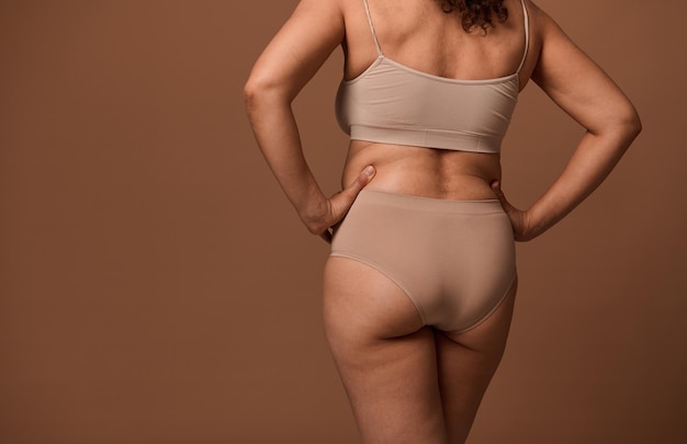 Vista posteriore del corpo femminile con difetti e imperfezioni isolato su sfondo beige con spazio pubblicitario copia. Positività corporea, amore per il proprio corpo, fiducia in se stessi e concetto di accettazione di sé