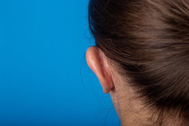 Vista posteriore dell'orecchio con le orecchie a zampa di giovane ragazza su sfondo blu. Otoplastica, chirurgia.