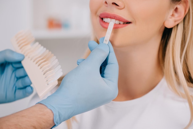 Vista ritagliata del dentista maschio che abbina il colore dei denti della donna con la tavolozza in clinica, sbiancamento dei denti