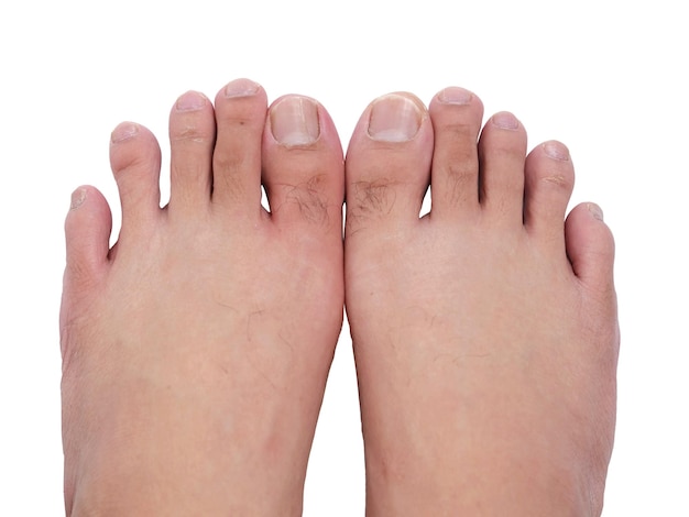 Vista superiore dei piedi umani, dita delle gambe tagliate su bianco