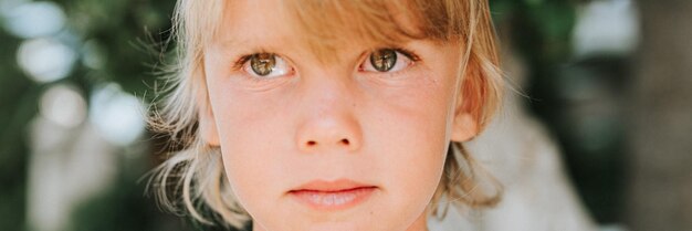 Volto ritratto di candido bambino bambino di cinque anni con problema di pelle allergica e lunghi capelli biondi e occhi verdi su sfondo di piante verdi durante un banner di viaggio per le vacanze estive