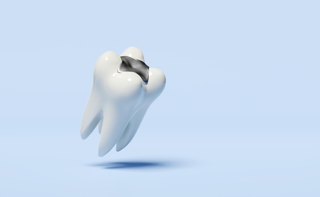 3d dental molar teeth model icon with filling material isolated on blue background dental examination of the dentist health of white teeth 3d render illustration