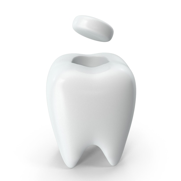 Dental Inlay Restoration