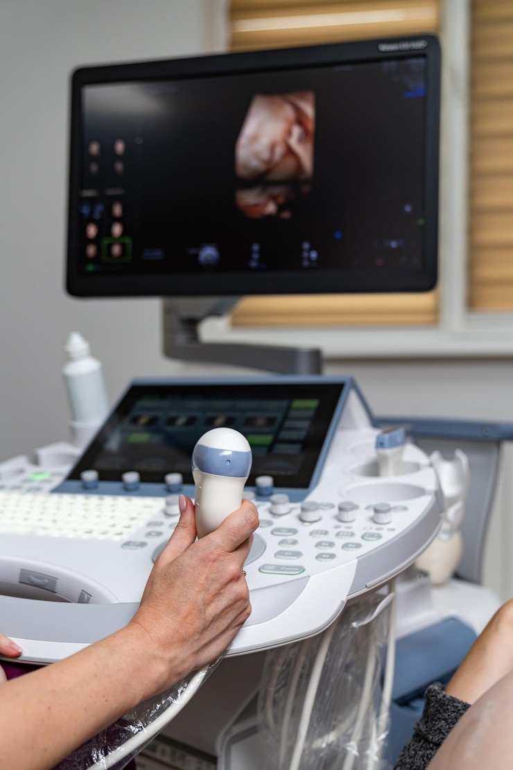Fotografie sonography professional diagnostic equipment modern ultrasound hospital monitoring