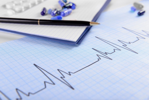Stethoscope on cardiogram sheet closeup