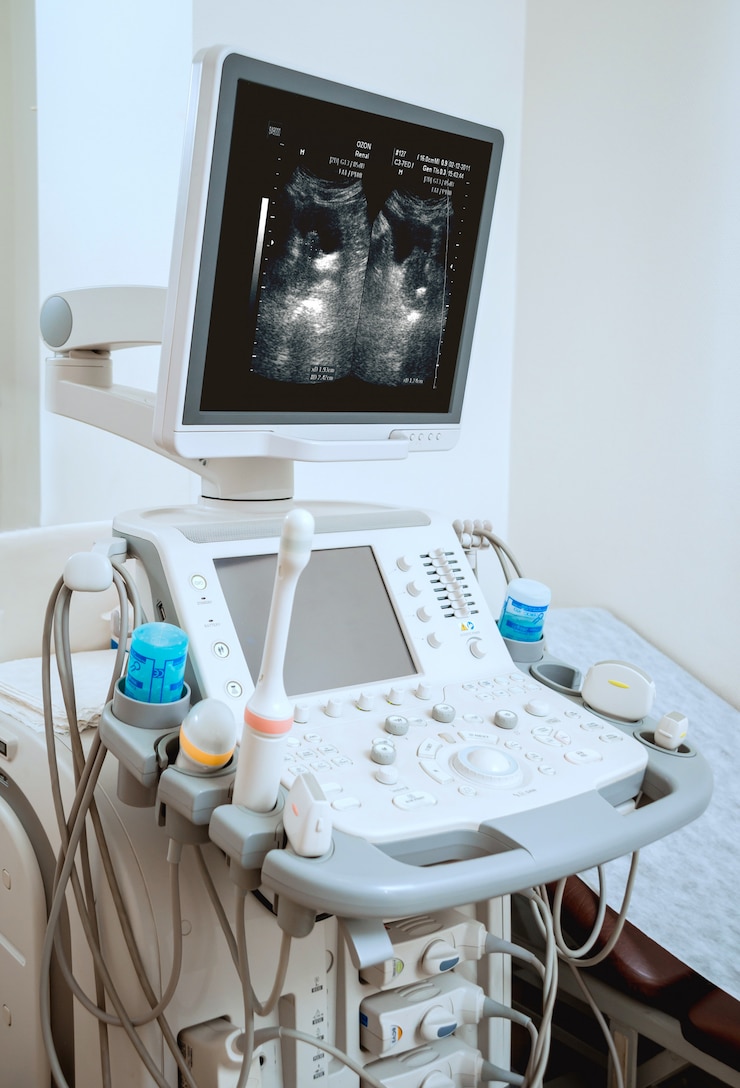 Fotografie ultrasound equipment. diagnostics and sonography.