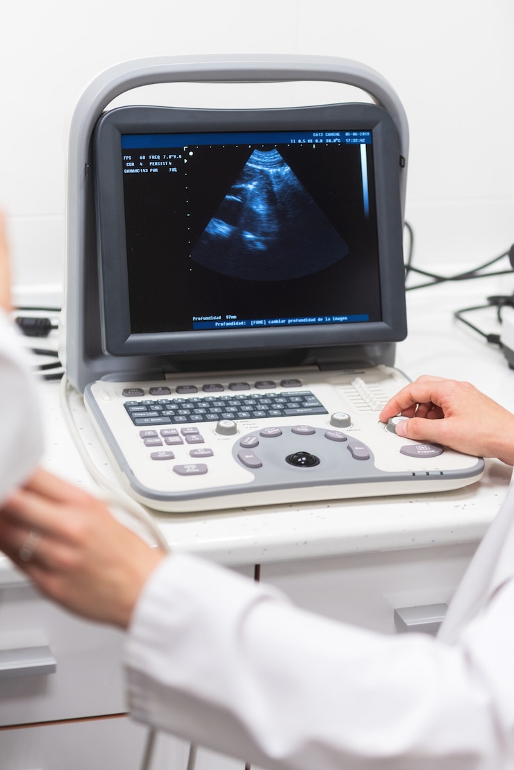 Fotografie ultrasound scanner in the hands of a doctor. 