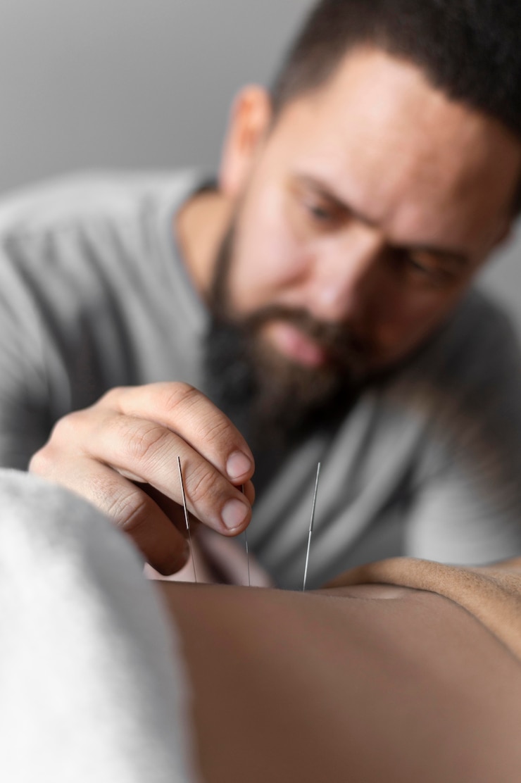 Zdarma Fotografie close-up therapist holding acupuncture needle