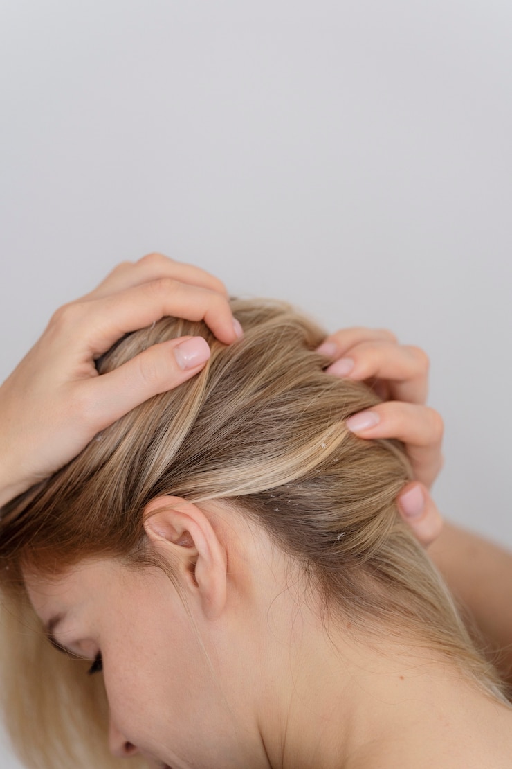 Zdarma Fotografie woman with dandruff issues close up