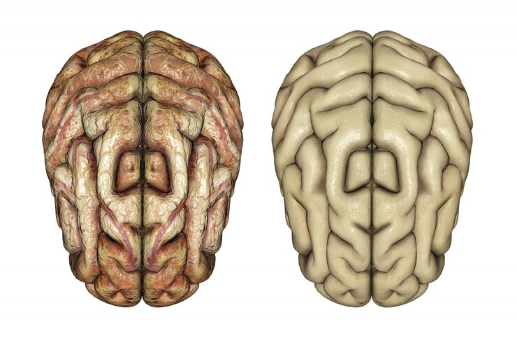 Foto grátis 3d rendem de dois cérebros um saudável e um doente