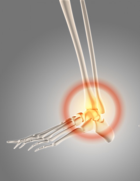 3D rendem de um esqueleto com tornozelo destacado para mostrar a dor
