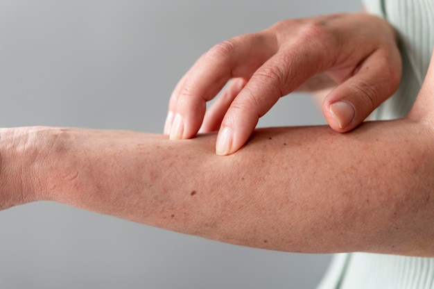 Alergia cutânea no braço de uma pessoa