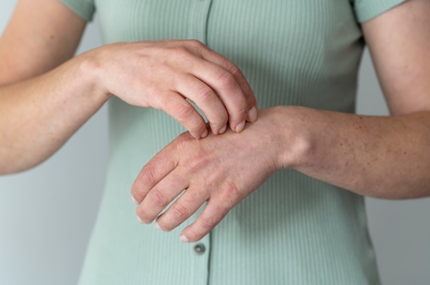 Foto grátis alergia cutânea nos braços de uma pessoa