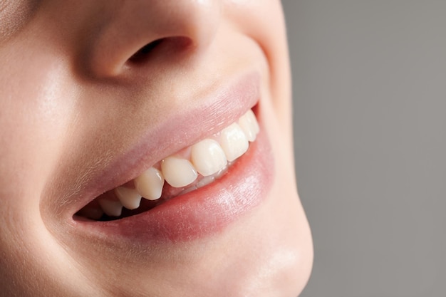 Belo sorriso feminino com dentes retos brancos